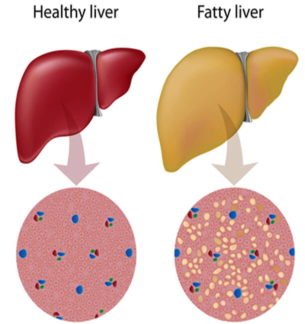 gastro specialist in chennai