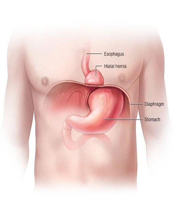 best hospital for gastroenterology in chennai