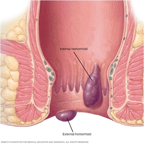 best gastroenterologist in chennai