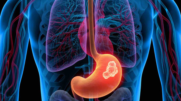 best gastroenterology doctors in chennai